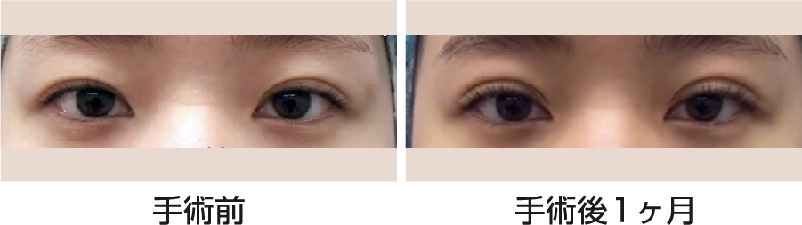 幅広い、華やかな二重