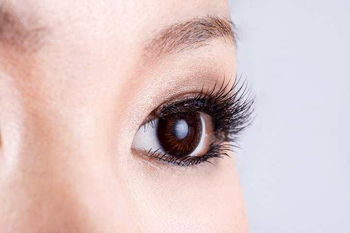 目頭切開について