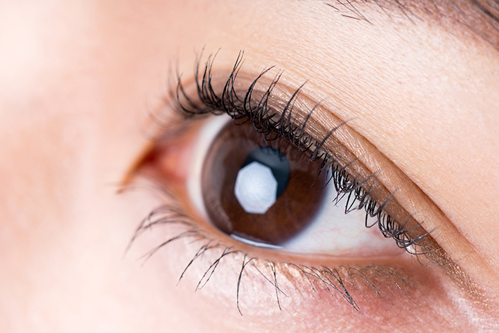 逆さまつ毛の種類と原因