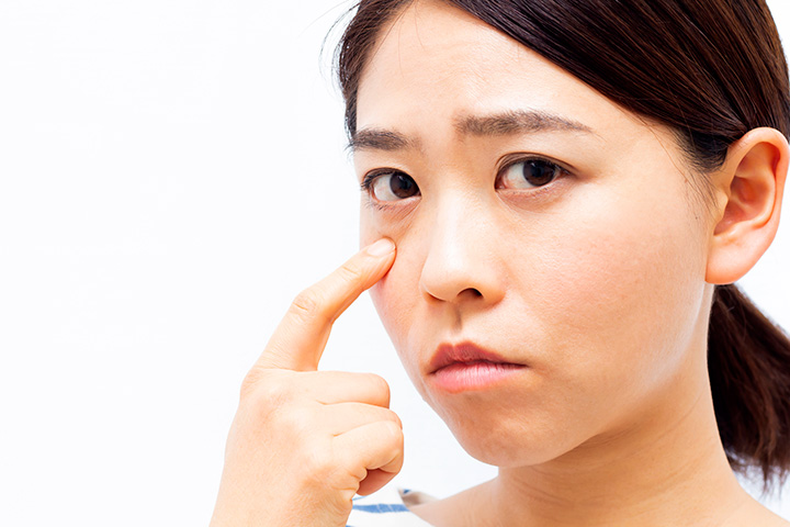 裏ハムラ法は眼窩脂肪（がんかしぼう）を移動させる術式