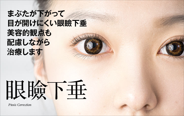 眼瞼下垂