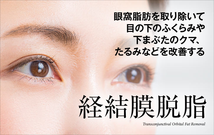 経結膜脱脂