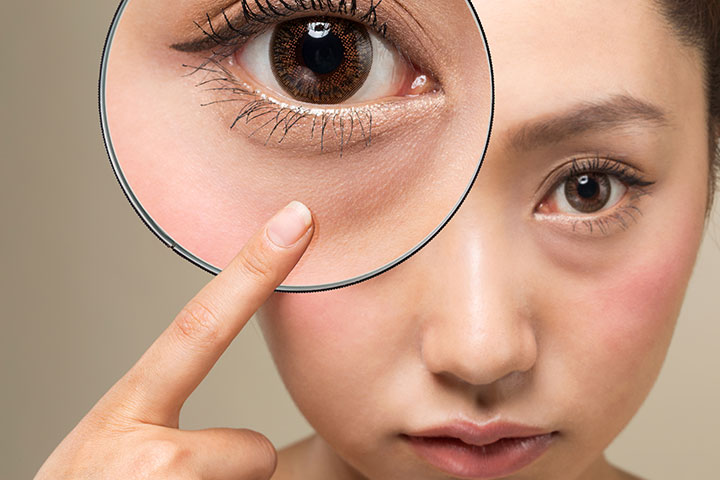 タレ目形成のリスク・デメリット