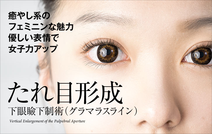 たれ目形成（下眼瞼下制）