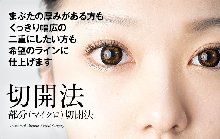 切開法・部分(マイクロ)切開法